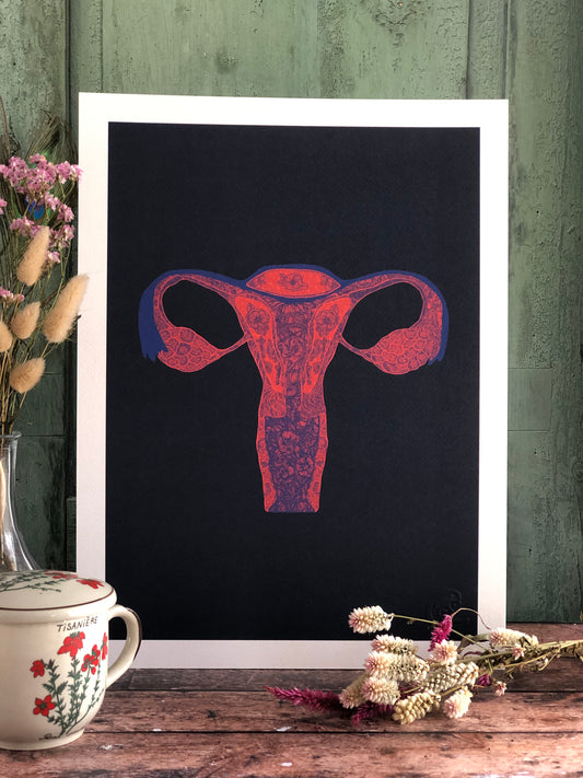 Affiche - Utérus