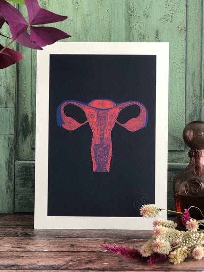 Affiche - Utérus