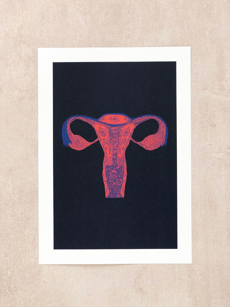 Affiche - Utérus