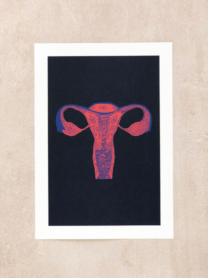 Affiche - Utérus